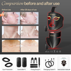 LuxRenew Red Light Therapy Mask Set, Led Mask Light Therapy for Face & Neck Near-Infrared