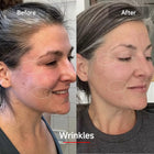 LED Red Light Therapy Mask